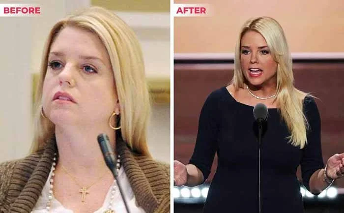 Pam Bondi weight loss before and after